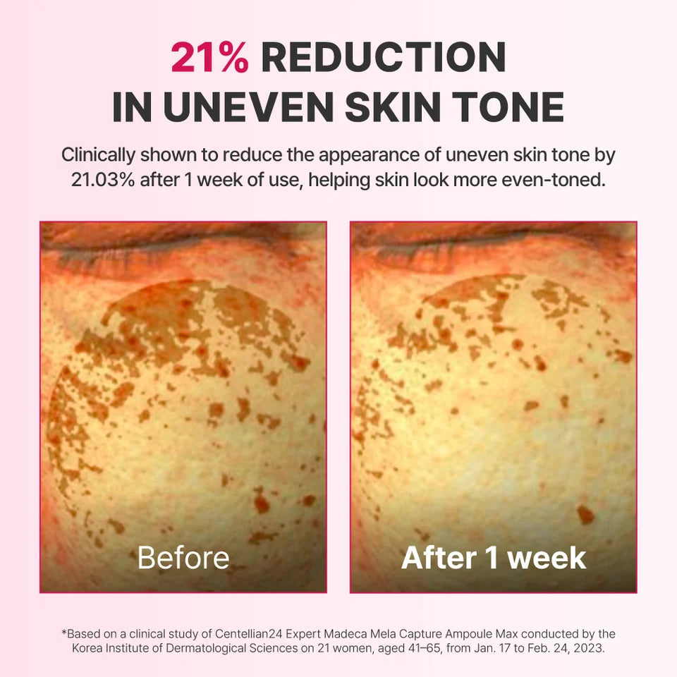 Centellian24 Expert Madeca Mela Capture Ampoule Max