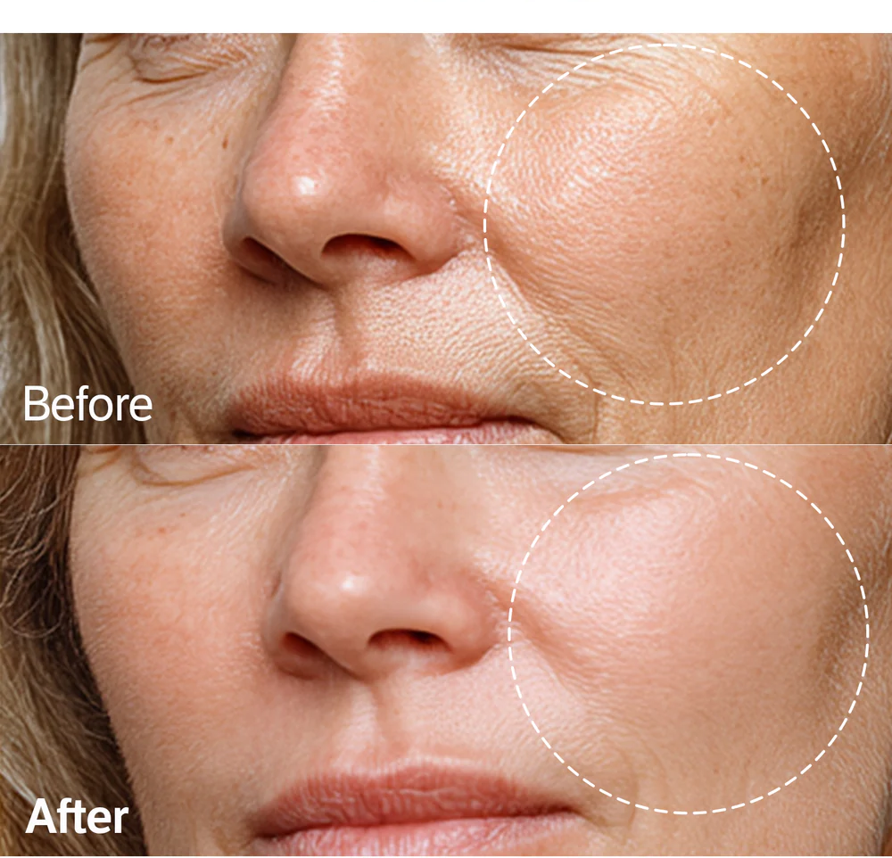 Sungboon Editor Deep Collagen Barrier Serum Mist