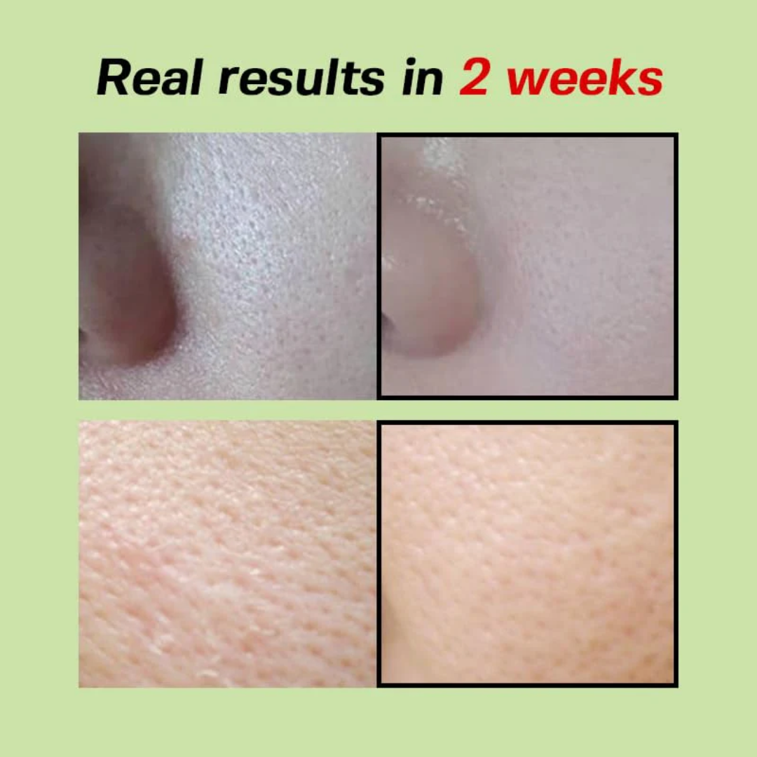 Sungboon Green Tomato Pore Lifting Ampoule+