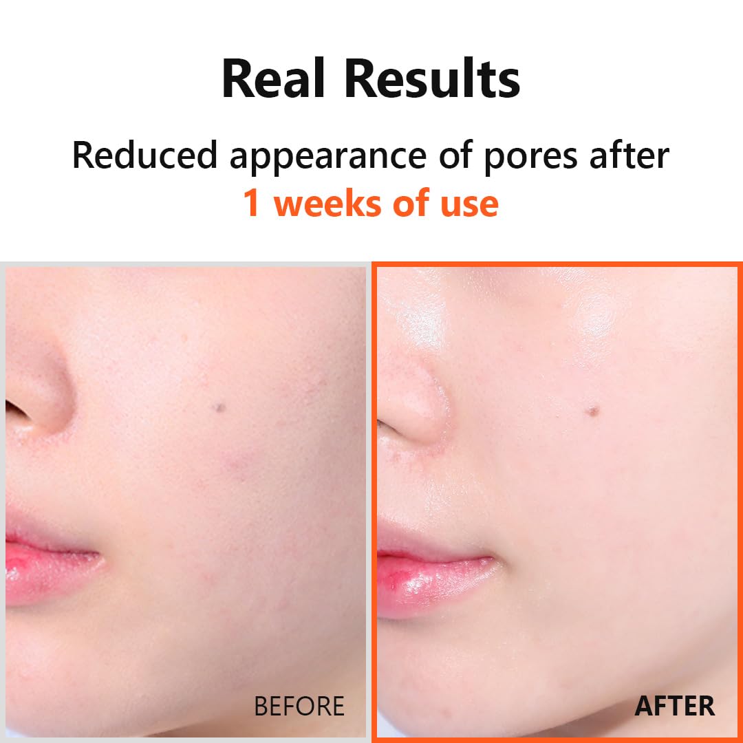 Isntree Hyper Niacinamide 20 Serum