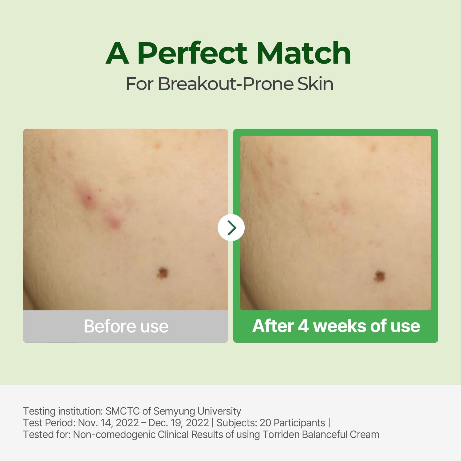 Torriden Balanceful Cica Cream