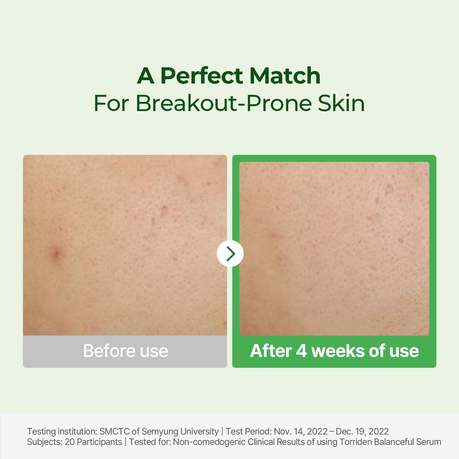 Torriden Balanceful Cica Serum