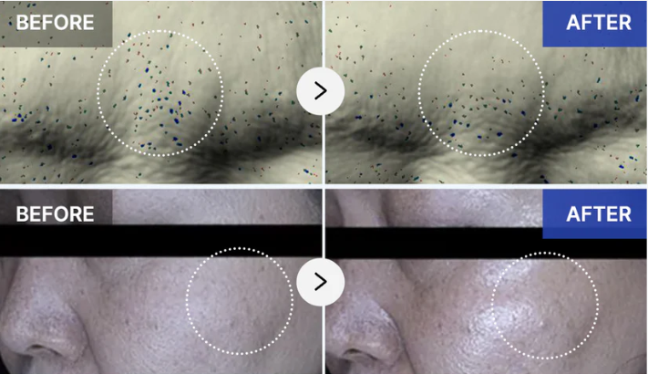 Kliniske studier på exosomer fra Medicube