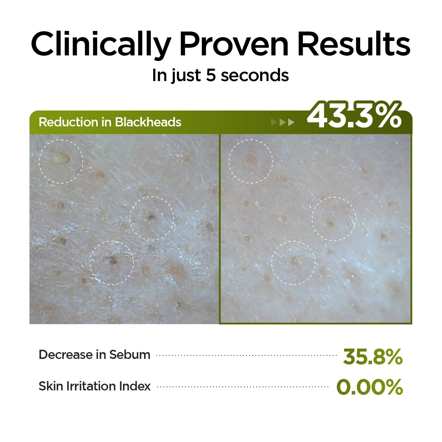 P.CALM Underpore Holy Basil Cleansing Oil