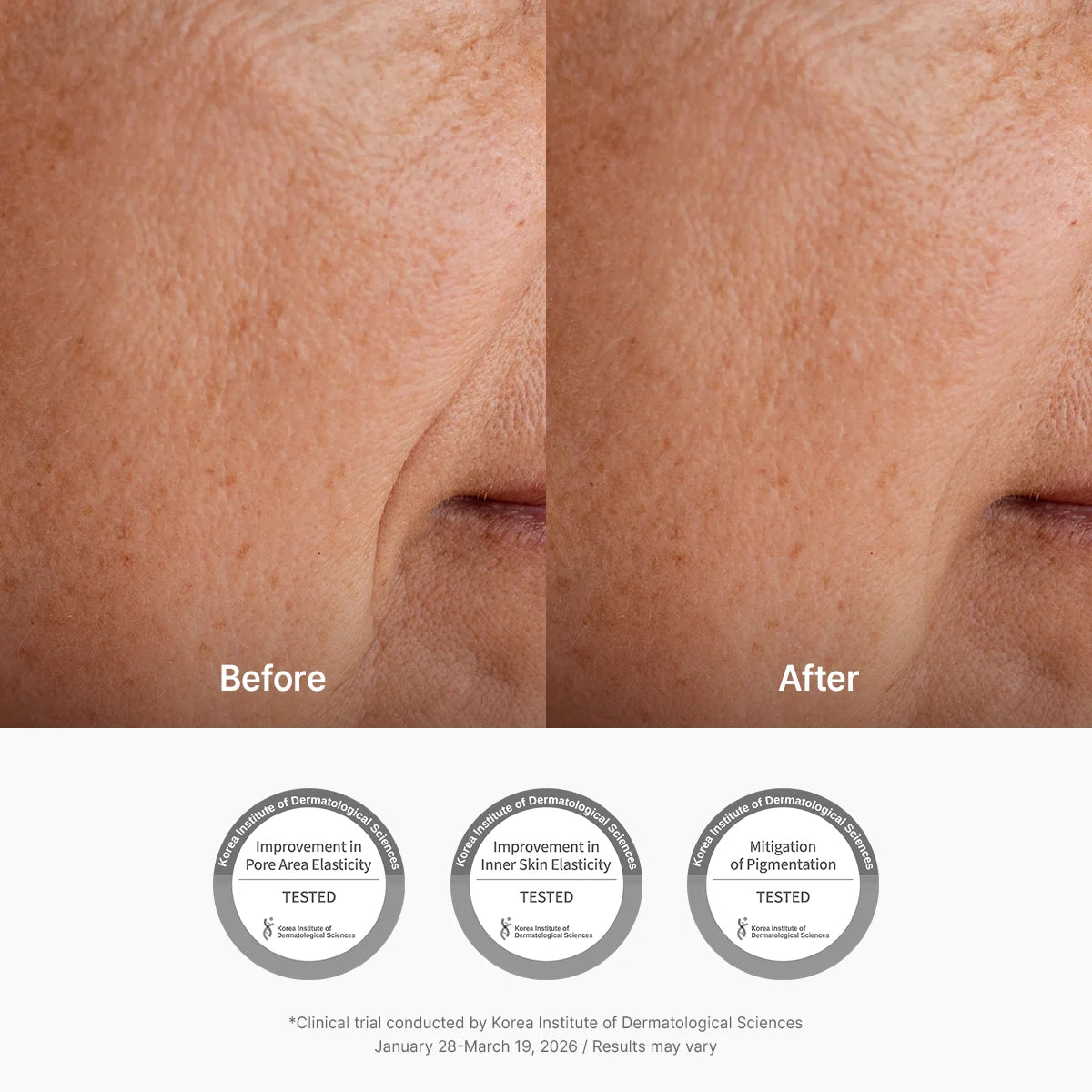 Dr. Althea Pure Retinol 0.15% Cream