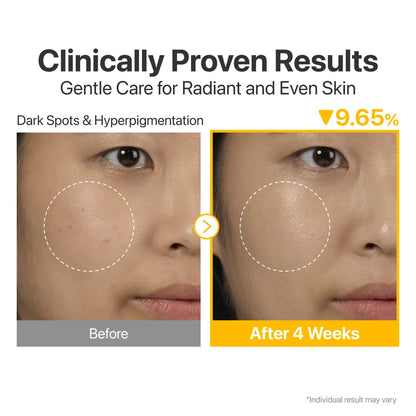 Numbuzin No.5 Vitamin Serum