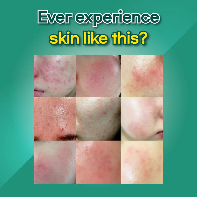 HYAAH All-in-One Ectoin Lotion