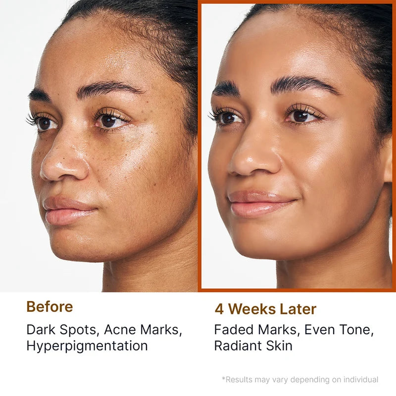 Sungboon Editor Kojic Acid Niacinamide Radiance Soothing Gel Cleanser