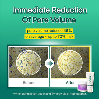 HYAAH All-in-One Ectoin Lotion