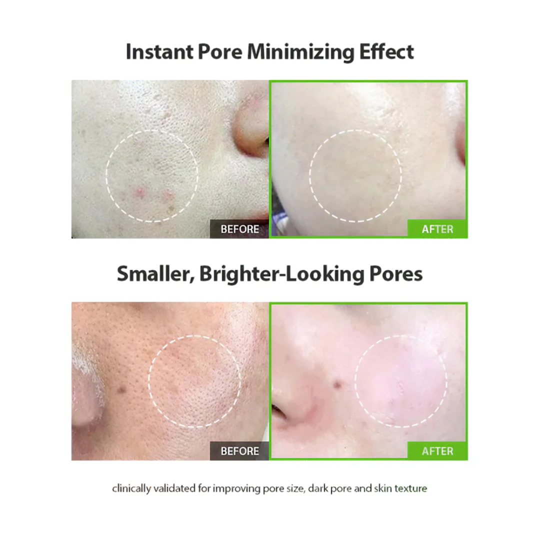 Sungboon Green Tomato Pore Lifting Ampoule+