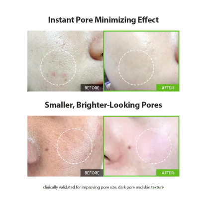 Sungboon Green Tomato Pore Lifting Ampoule+