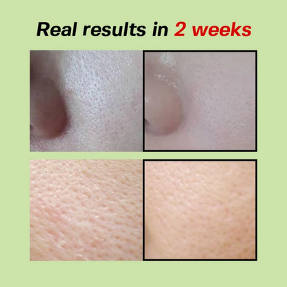 Sungboon Green Tomato Pore Lifting Ampoule+
