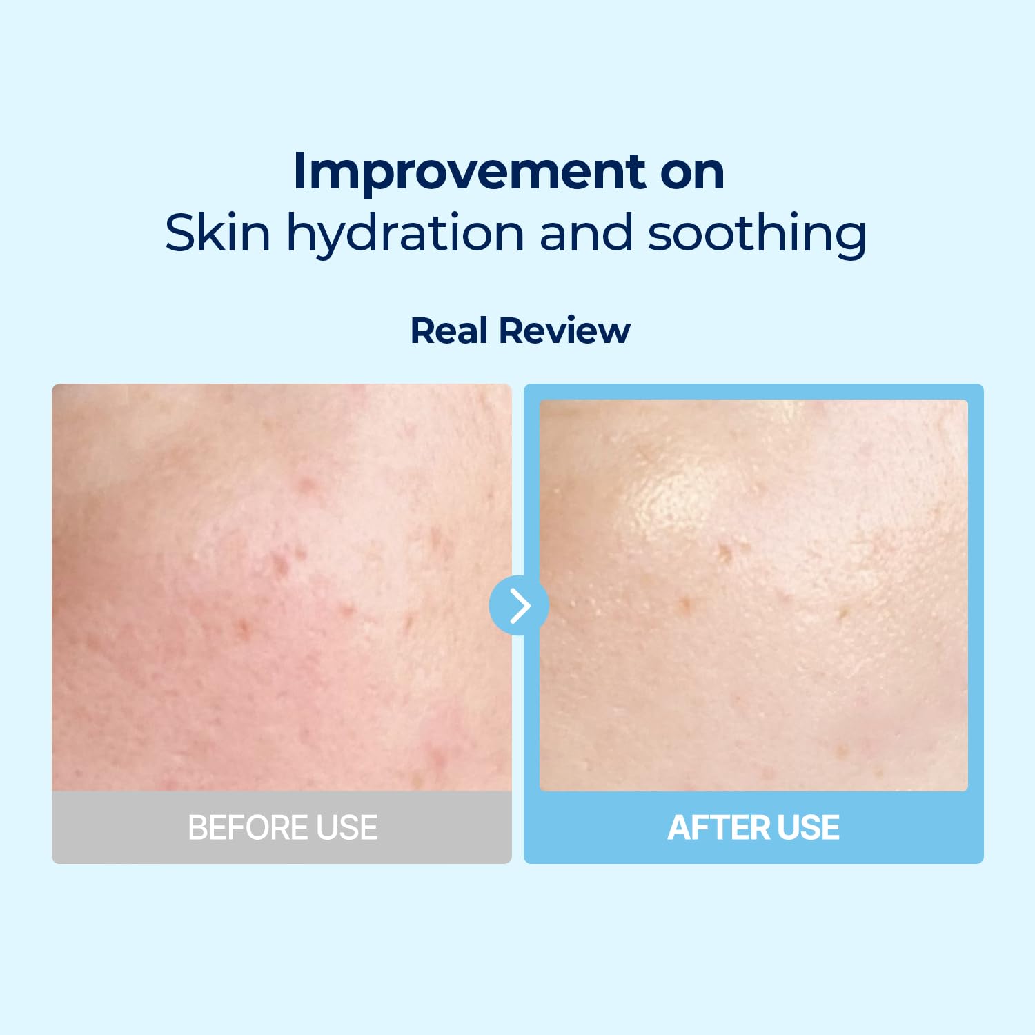 Torriden Dive In Low Molecule Hyaluronic Acid Multi Pad