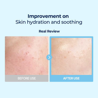 Torriden Dive In Low Molecule Hyaluronic Acid Multi Pad