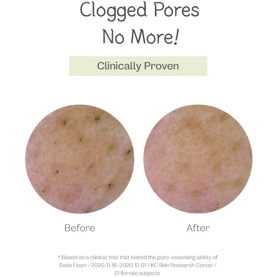 ma:nyo Deep Pore Cleansing Soda Foam